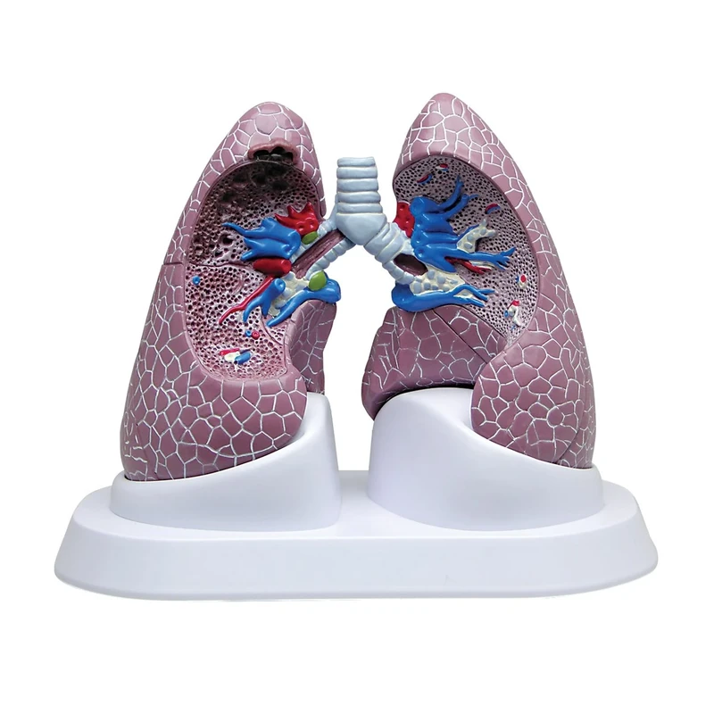 3B Scientific Lung Set with Pathologies