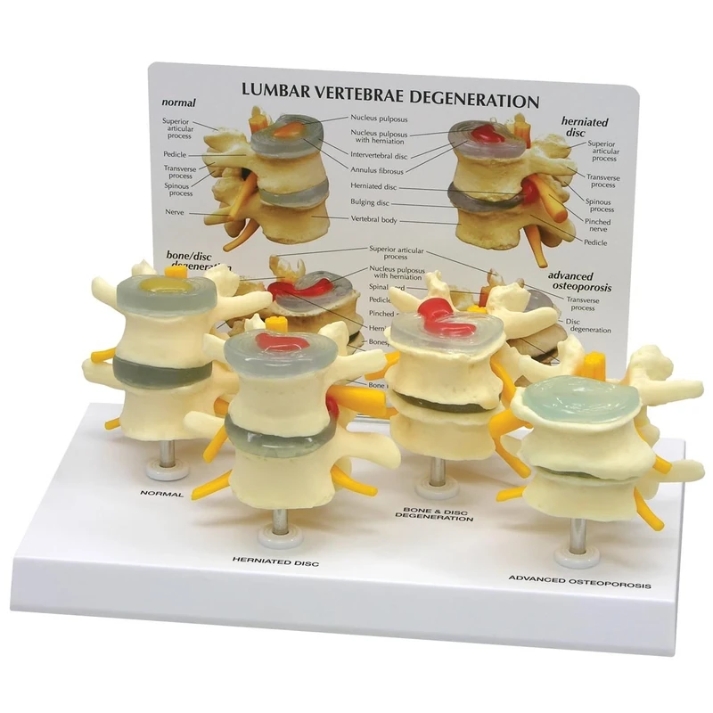 3B Scientific 4-Stage Vertebrae Model Set