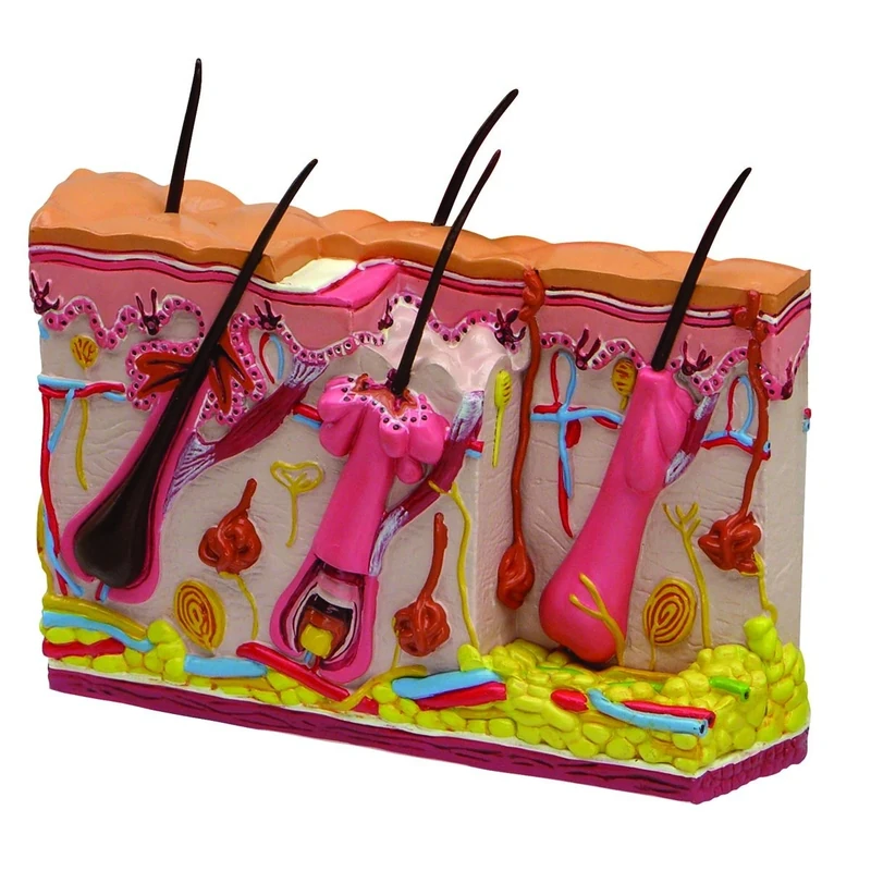 3B Scientific Skin Acne Model, 2 Sided