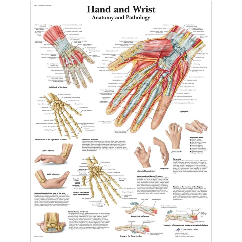 3B Scientific VR1171UU Human Anatomy - Hand and Wrist Anatomy/Pathology Chart, Paper Version, 0.25 cm*50.8 cm*63.5 cm