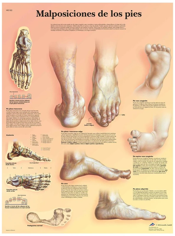 3B Scientific VR3185L "Lesiones deportivas" Printed in Paper - Image 1