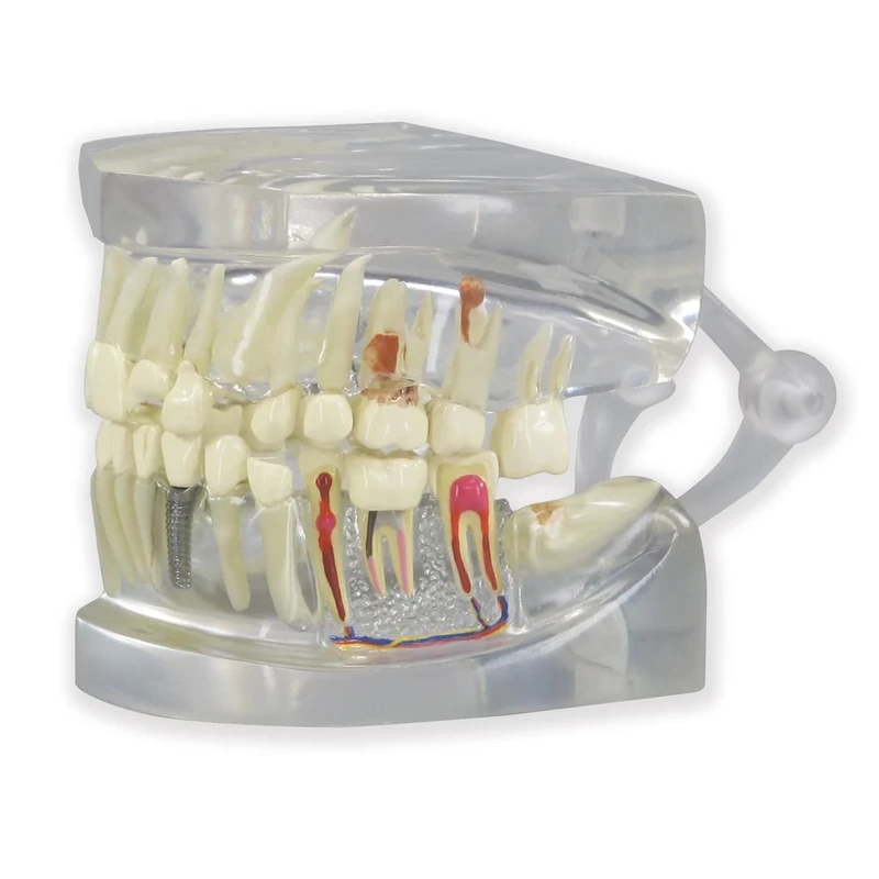 3B Scientific Clear Human Jaw with teeth model