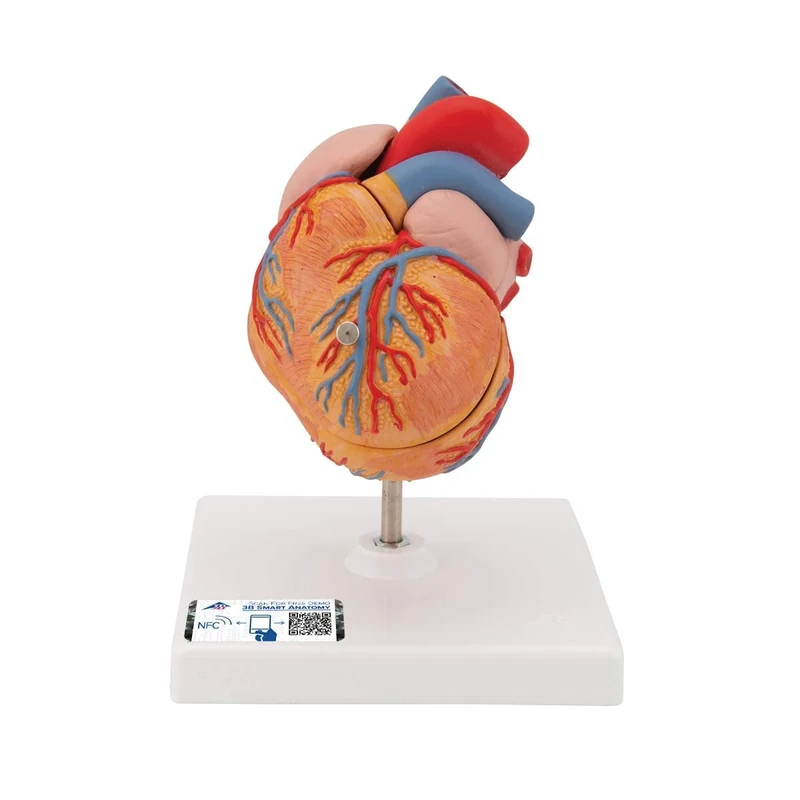 3B Scientific Human Anatomy - Classic Heart Model with Left Ventricular Hypertrophy, 2 Part + free anatomy software - 3B Smart Anatomy