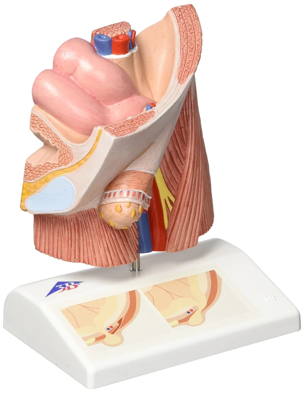 3B Scientific H13 Inguinal Hernia Model + free Anatomy App - 3B Smart Anatomy