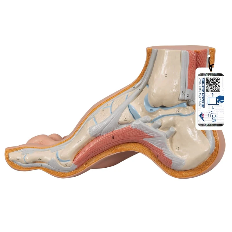 3B Scientific M32 Hollow Foot, Pes Cavus + free anatomy software - 3B Smart Anatomy
