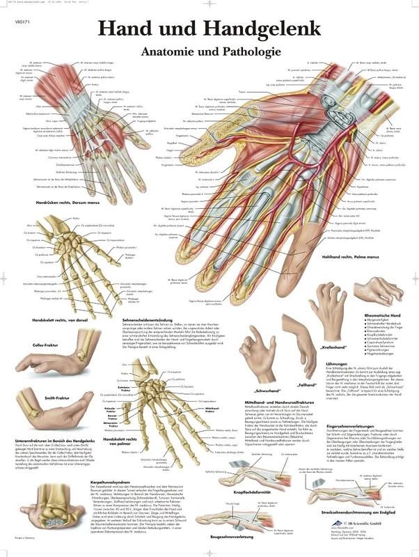 3B Scientific Hand and Wrist Anatomy Chart, Hand & Wrist Anatomy and Pathology Educational Poster, Orthopedic Wall Chart for Medical Students, Physiotherapy, Nursing & Healthcare Education