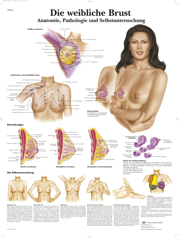 3B Scientific Chart The Female Breast Anatomy, Pathology and Self-Examination, 1