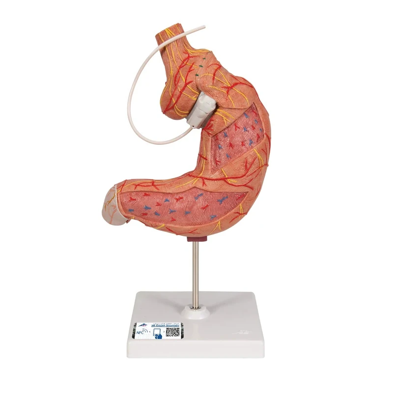 3B Scientific K15/1 Gastric Band Model + free Anatomy App - 3B Smart Anatomy