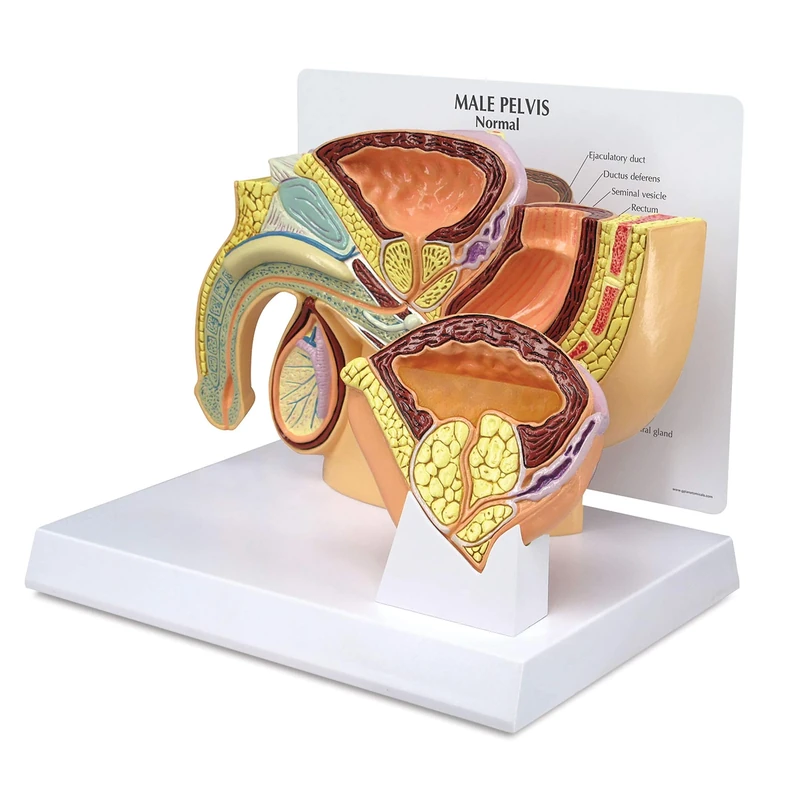 3B Scientific Male Pelvis BPH Model