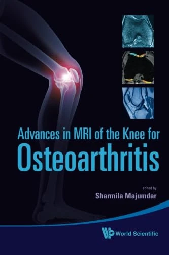 Advances In Mri Of The Knee For Osteoarthritis