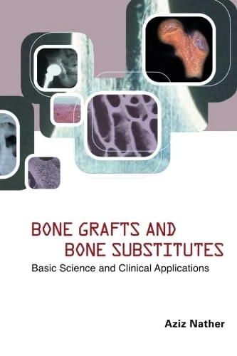Bone Grafts And Bone Substitutes: Basic Science And Clinical Applications
