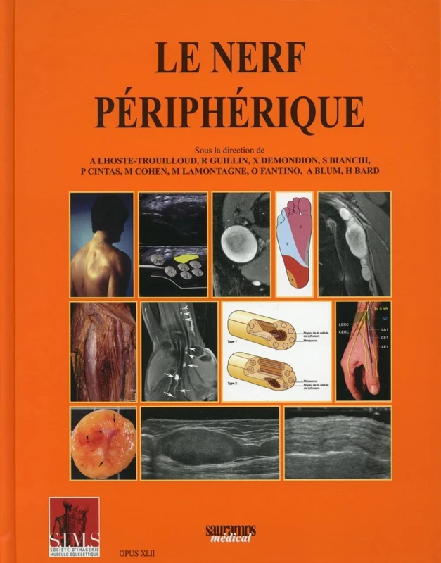 LE NERF PERIPHERIQUE - SIMS - Image 1