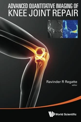 Advanced Quantitative Imaging Of Knee Joint Repair
