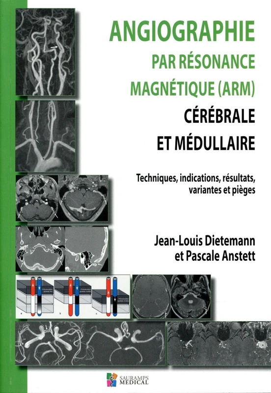 ANGIOGRAPHIE PAR RESONANCE MAGNETIQUE (ARM) CEREBRALE ET MEDULLAIRE: Techniques, indications, résultats, variantes et pièges - Image 1
