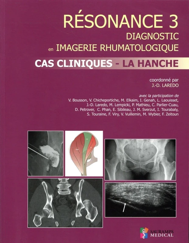 RESONANCE 3 CAS CLINIQUES- LA HANCHE: Diagnostic en imagerie rhumatologique Tome 3, Cas cliniques, la hanche