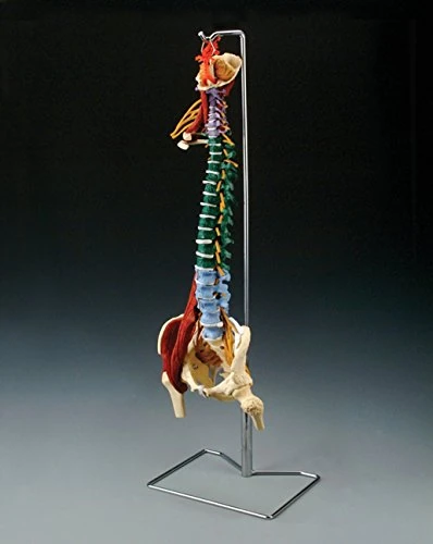 Anatomical Chart 0000CH5900 "Muscle Spine with Disorder" Skeletal Model, 86.4 cm H