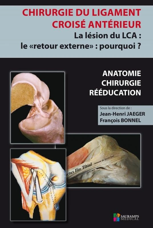 Chirurgie Du Ligament Croisé Antérieur Du Genou: La Lésion Du Lca - Le Retour Externe - Pourquoi?