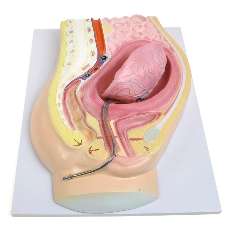 HeineScientific Anatomical Model of Placental Abruption - Image 1