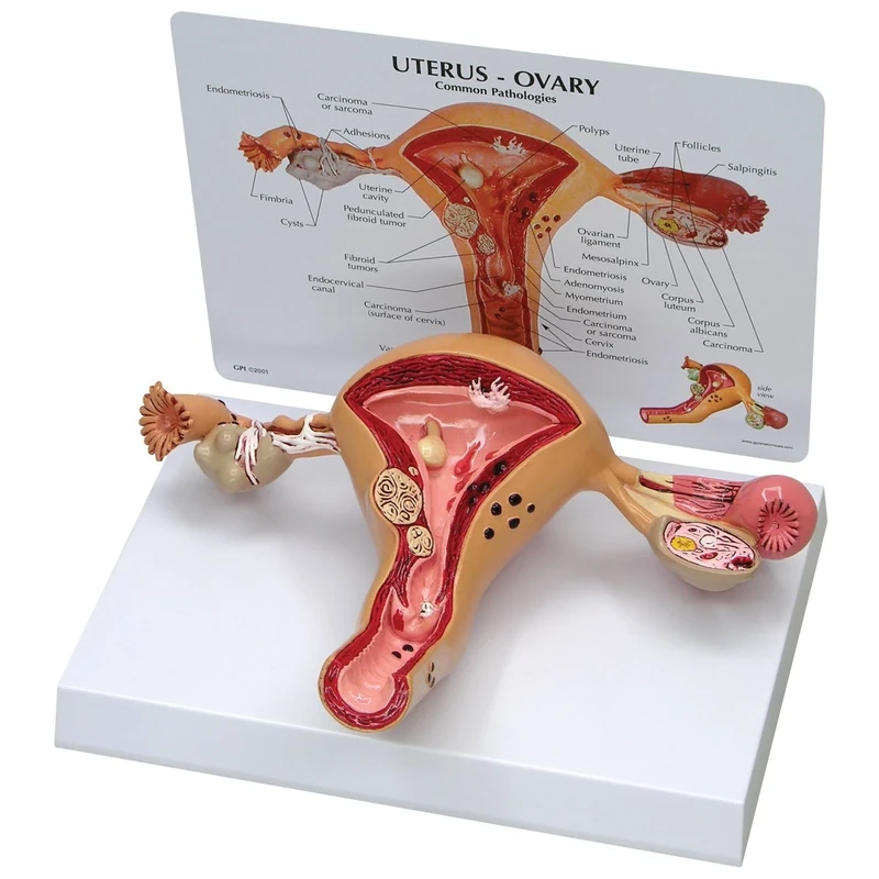 3B Scientific 1019594 Uterus-Ovary Model
