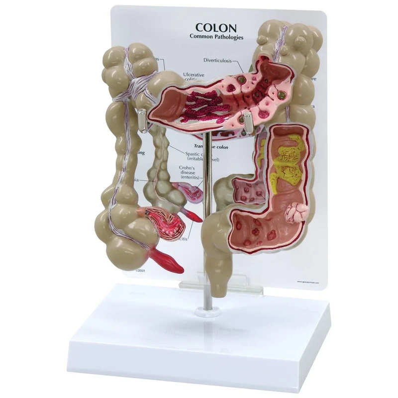 3B Scientific Colon Model