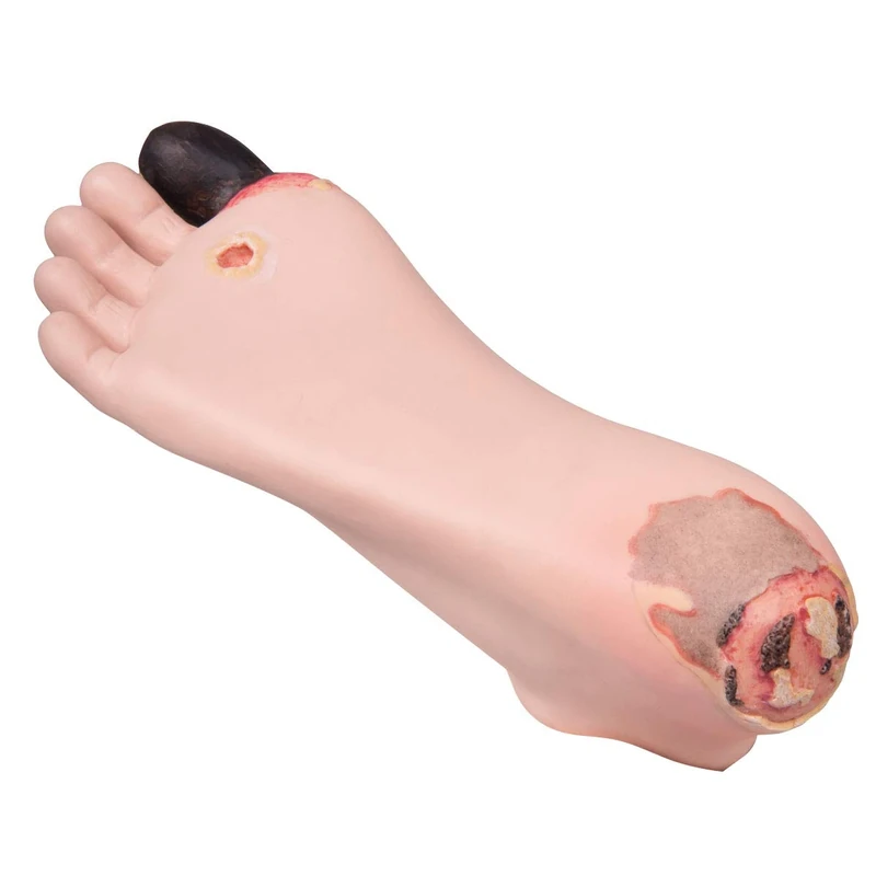 3B Scientific P14 Decubitus Care Simulator, Foot