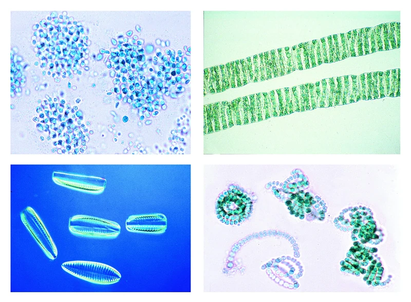 3B Scientific Biology Microscopy Micropräparate Series_ Environment I: Forest: Cause & Effects of Forest Damage