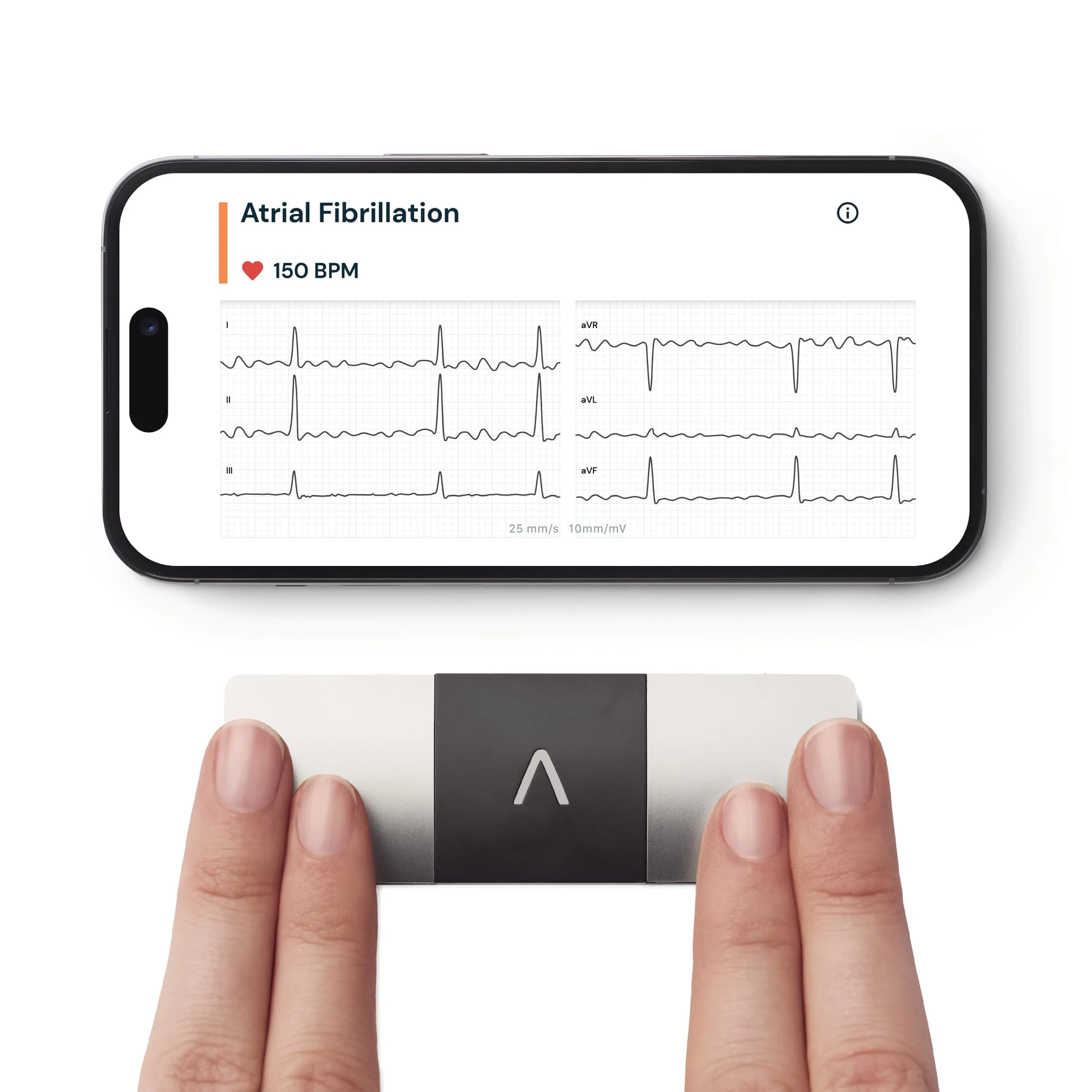 KardiaMobile 6-Lead Personal ECG Heart Rate Monitor - Detects Atrial Fibrillation, Trusted by the NHS, Results in 30 Seconds, Works with Most Smartphones, Supporting British Heart Foundation