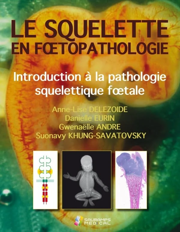 LE SQUELETTE EN FOETOPATHOLOGIE. INTR.A LA PATHOLOGIE SQUELETTIQUE FOETALE: L'os normal : développement, imagerie, structure
