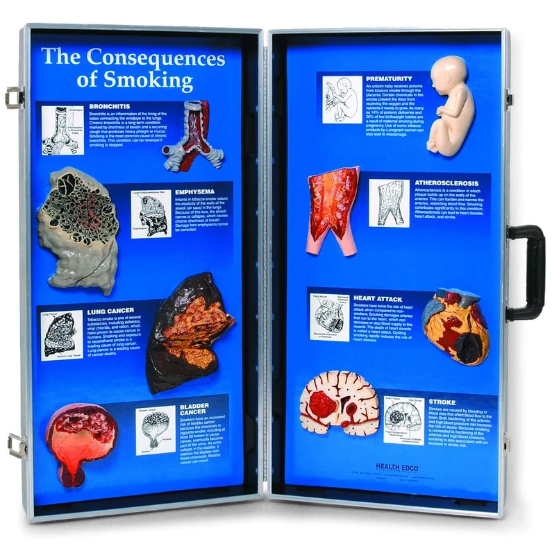 WRS Group Consequences of Smoking, 3D Info Board