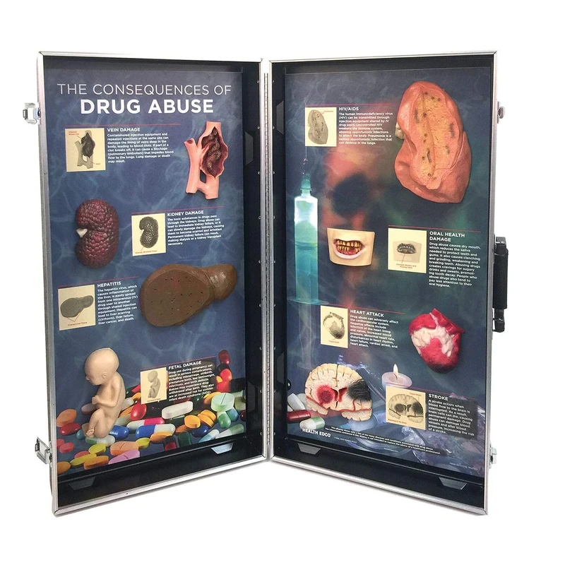 WRS Group Consequences of Drug Abuse, 3D Info Board