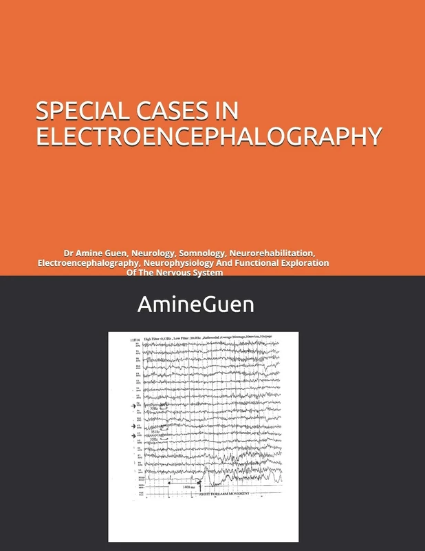 SPECIAL CASES IN ELECTROENCEPHALOGRAPHY: Dr Amine Guen, Neurology, Somnology, Neurorehabilitation, Electroencephalography, Neurophysiology And Functional Exploration Of The Nervous System