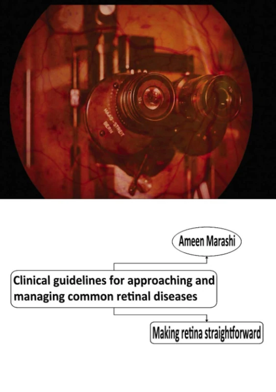 Clinical guidelines for approaching and managing common retinal diseases: Making retina straightforward