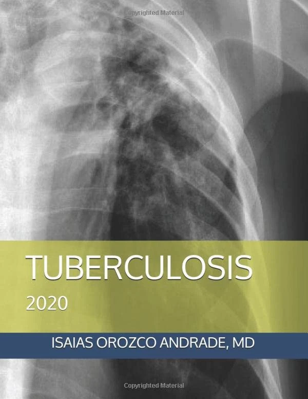 TUBERCULOSIS: 2020