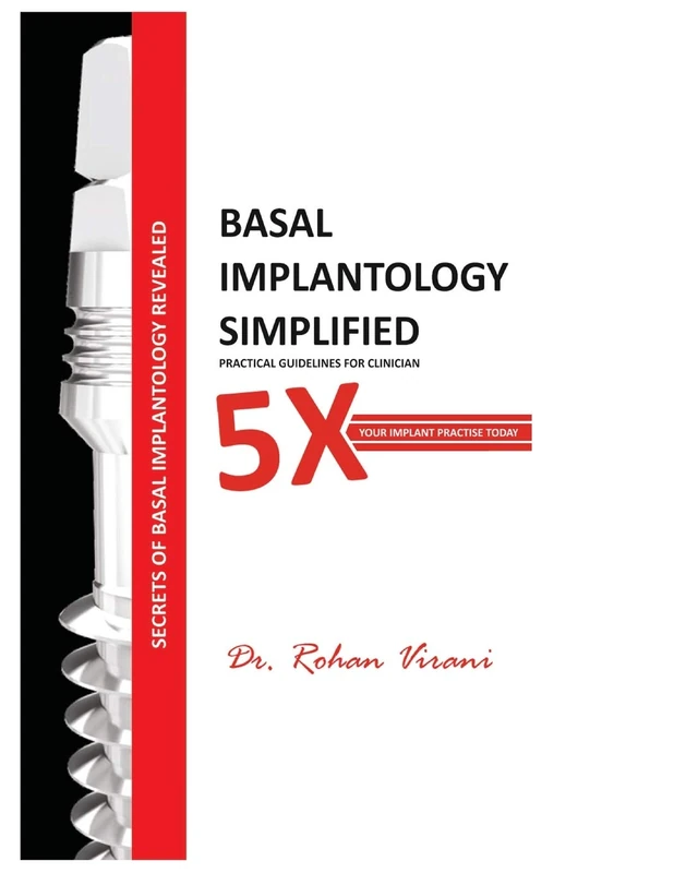 BASAL IMPLANTOLOGY SIMPLIFIED: 5x YOUR IMPLANT PRACTISE: 1 (DENTAL IMPLANTS)