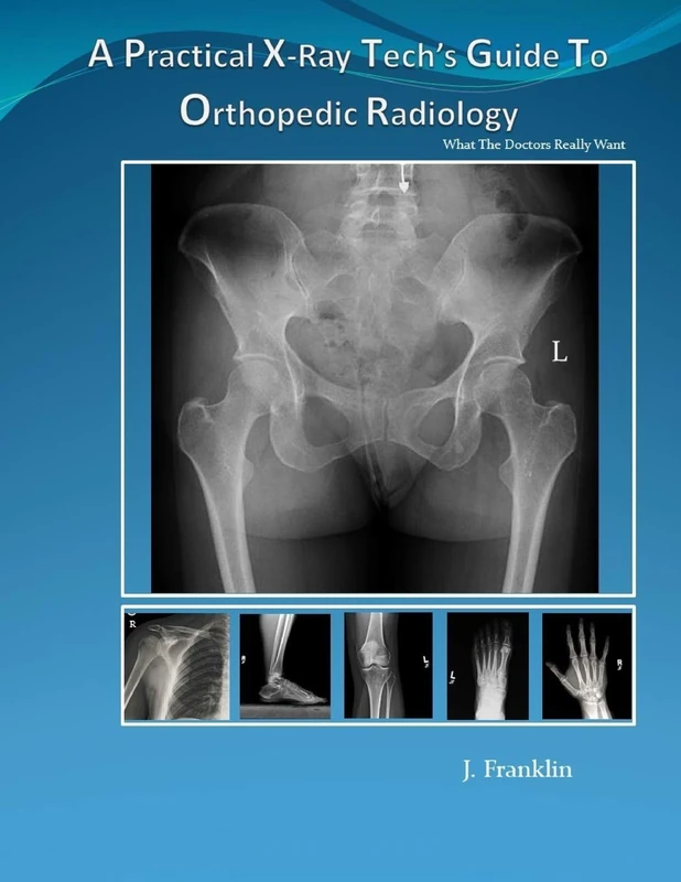 A Practical X-Ray Tech's Guide To Orthopedic Radiology: What the Doctors really want