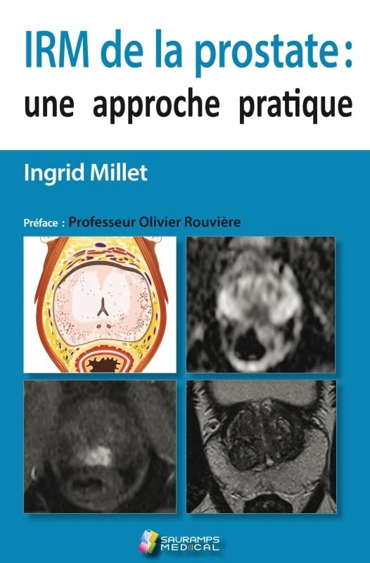 IRM DE LA PROSTATE : UNE APPROCHE PRATIQUE