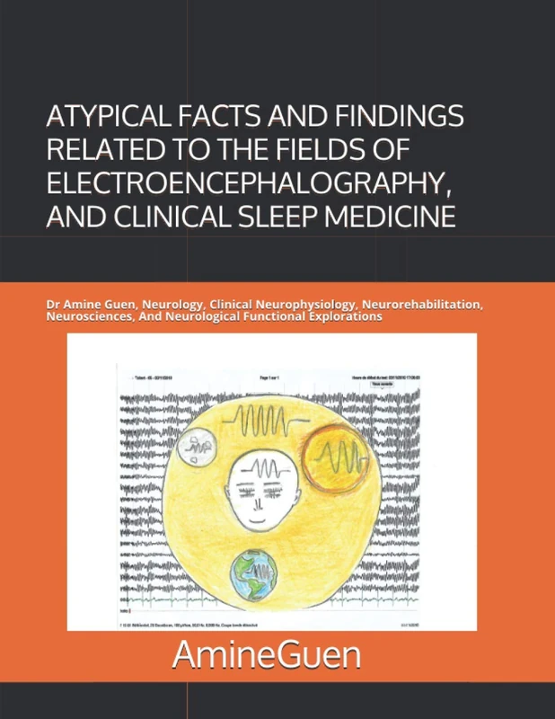 ATYPICAL FACTS AND FINDINGS RELATED TO THE FIELDS OF ELECTROENCEPHALOGRAPHY, AND CLINICAL SLEEP MEDICINE: Dr Amine Guen, Neurology, Clinical ... And Neurological Functional Explorations