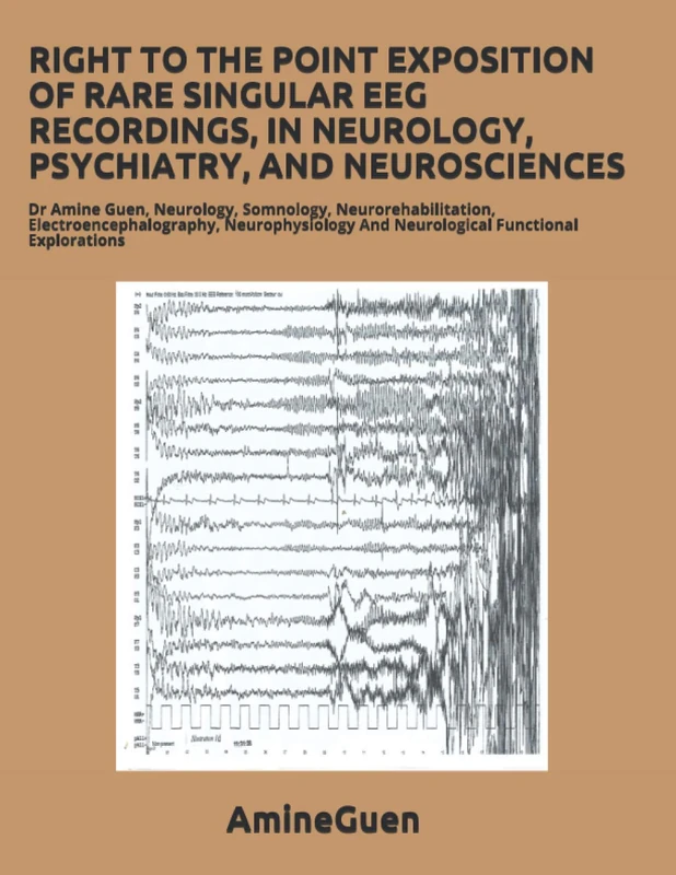RIGHT TO THE POINT EXPOSITION OF RARE SINGULAR EEG RECORDINGS, IN NEUROLOGY, PSYCHIATRY, AND NEUROSCIENCES: Dr Amine Guen, Neurology, Somnology, ... And Neurological Functional Explorations