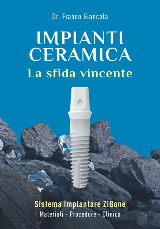 Impianti Ceramica: La sfida vincente