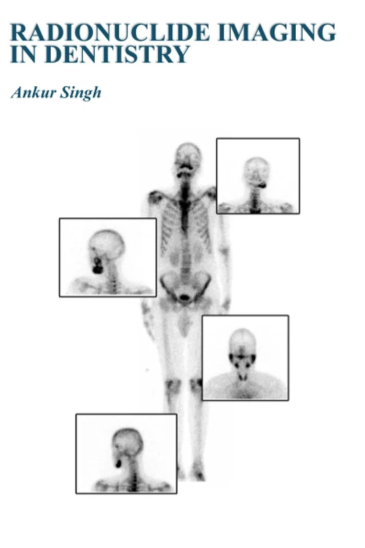Radionuclide Imaging in Dentistry