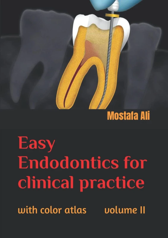 Easy endodontics for clinical practice with color atlas volume II