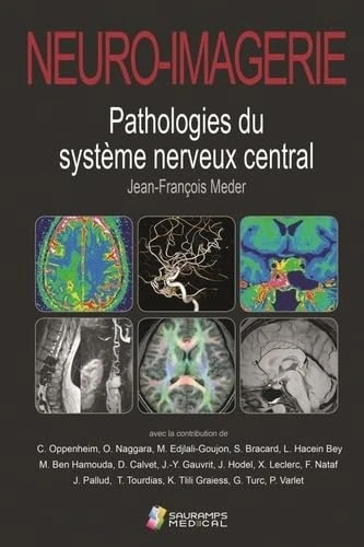 NEURO-IMAGERIE. PATHOLOGIES DU SYSTEME NERVEUX CENTRAL 2ED: Pathologies du système nerveux central