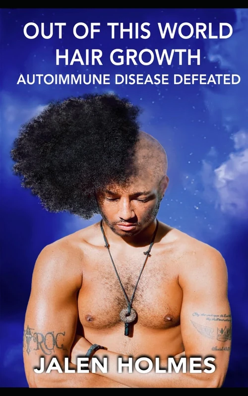 Out Of This World Hair Growth: Autoimmune Disease Defeated