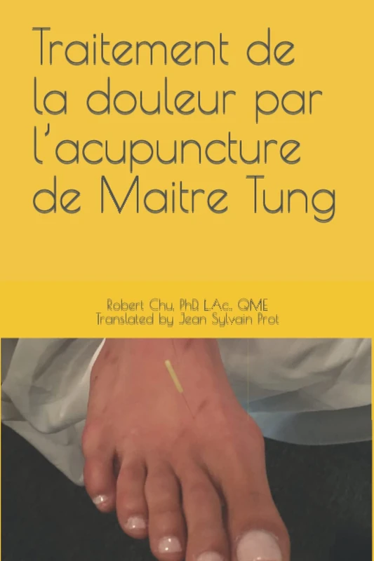 Traitement de la douleur par l’acupuncture de Maitre Tung