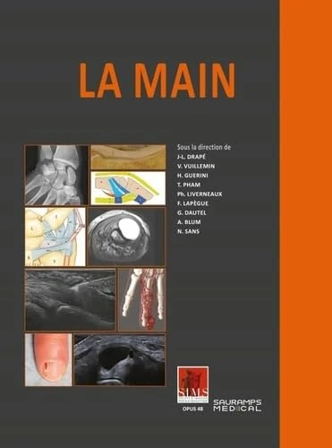 LA MAIN. SIMS: Poignet, Doigt, Main Rhumatologique et Tumorale - Image 1