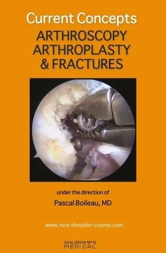 CURRENT CONCEPTS. ARTHROSCOPY, ARTHROPLASTY & FRACTURES: COLL NICE SHOULDER