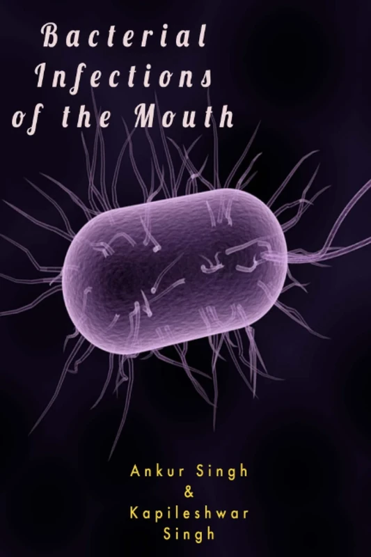 Bacterial Infections of the Mouth