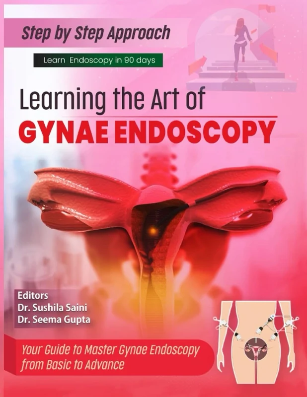 Step by step approach : Learning the art of gynae endoscopy: Learn endoscopy in 90 days, master the gynae endoscopy from basic to advance