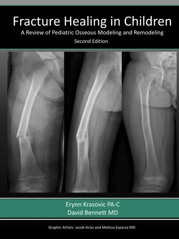 Fracture Healing in Children: A Review of Pediatric Osseous Modeling and Remodeling Second Edition