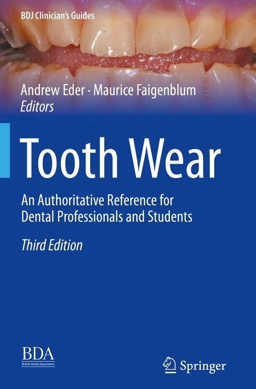 Tooth Wear: An Authoritative Reference for Dental Professionals and Students (BDJ Clinician’s Guides)